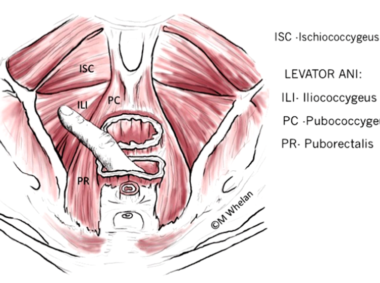 Physiotherapy First For Pelvic Floor Dysfunction Urology News
