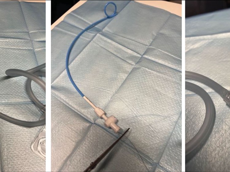 nephrostomy tube dressing Care-Weekly & Bag Changes Assessment and management of percutaneous