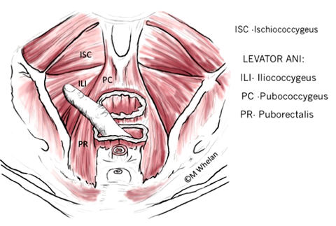 Physiotherapy first for pelvic floor dysfunction | Urology News