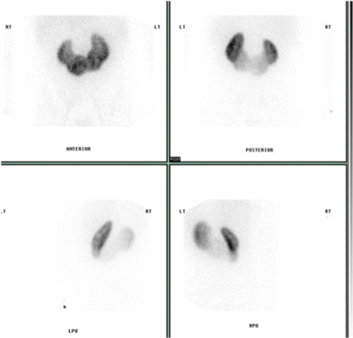 show pictures of kidneys show pictures of kidneys