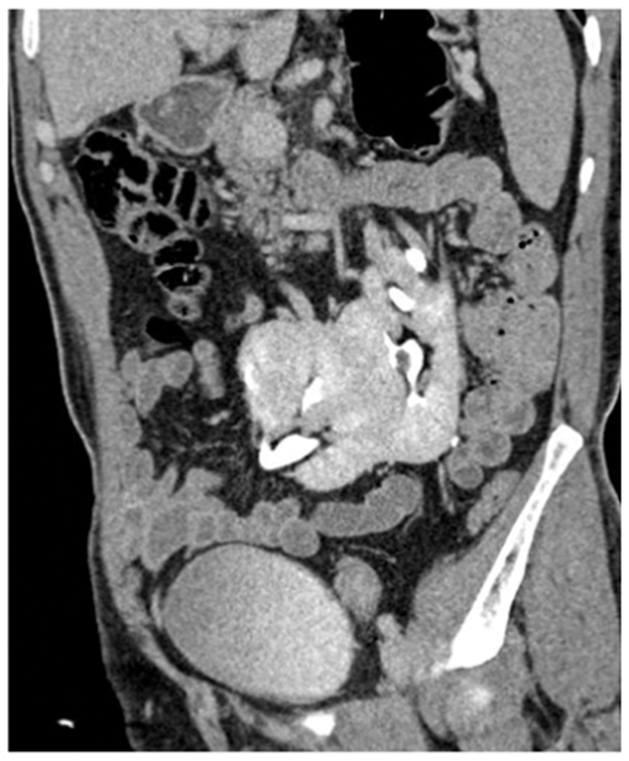 show pictures of where kidneys are located