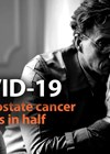 Covid-19 and prostate cancer article photo link