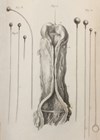 Image showing urethral stricture surrounded by the bougies used to diagnose and treat it. Engraved by Charles Bell’s, Letters on Urethral Diseases, 1810.
