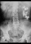 Scan of hip area.