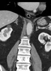 CT scan image.