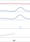 Diagram showing urodynamics trace.
