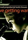 Using cryopreserved prepubertal testis tissues graphic image link.