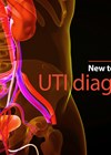 UTI diagnosis article graphic link image.