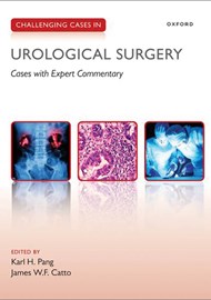 Challenging Cases in Urological Surgery book cover image.