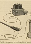 Illustration showing Thompson’s microphone sound, from Diseases of the Urinary Organs.