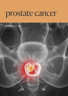 Prostate Cancer Issue II