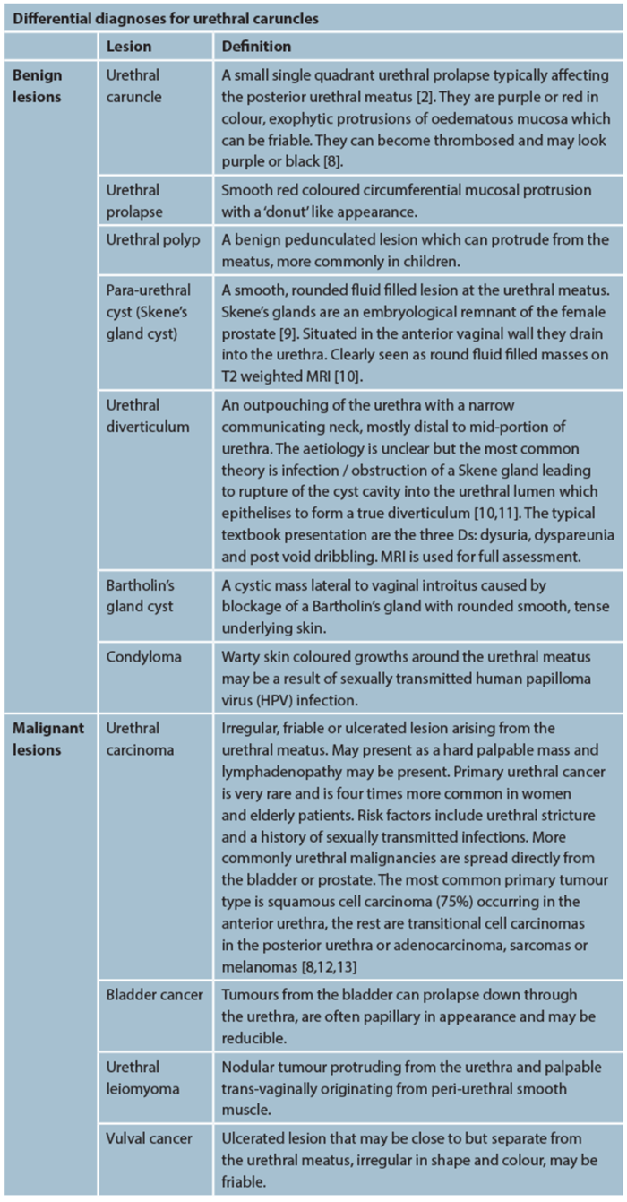 A Review Of The Diagnosis And Management Of Urethral Caruncles Urology News